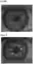 Fig. 06 - Device and method to determine a state of a lacrimal layer