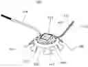 Fig. 01 - Glaucoma Surgery Visualization Apparatus