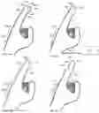 Fig. 05 - SYSTEMS AND METHODS FOR DELIVERING, ELICITING, AND MODIFYING TACTILE SENSATIONS USING ELECTROMAGNETIC RADIATION