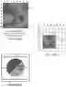Fig. 22 - Systems, devices, components and methods for detecting the locations of sources of cardiac rhythm disorders in a patient's heart and classifying same