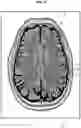 Fig. 06 - MAGNETIC RESONANCE IMAGING APPARATUS AND METHOD OF CONTROLLING THE SAME