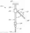 Fig. 01 - Hip surgery systems and methods