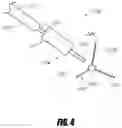Fig. 06 - Hip surgery systems and methods