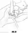 Fig. 35 - Hip surgery systems and methods