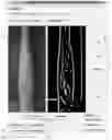 Fig. 01 - Systems and methods for autonomous intravenous needle insertion