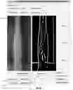 Fig. 27 - Systems and methods for autonomous intravenous needle insertion