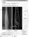 Fig. 28 - Systems and methods for autonomous intravenous needle insertion
