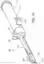 Fig. 09 - Medical apparatus and method for attaching a suture to a bone