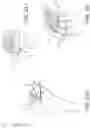 Fig. 14 - Medical apparatus and method for attaching a suture to a bone