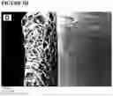 Fig. 09 - Devices and methods for nerve regeneration