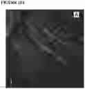 Fig. 22 - Devices and methods for nerve regeneration
