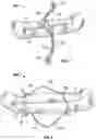 Fig. 07 - Appendage clamp deployment assist device