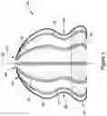 Fig. 02 - OCCLUSIVE DEVICE WITH EXPANDABLE MEMBER