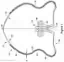 Fig. 04 - OCCLUSIVE DEVICE WITH EXPANDABLE MEMBER