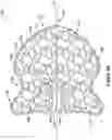 Fig. 07 - OCCLUSIVE DEVICE WITH EXPANDABLE MEMBER