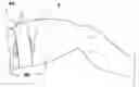 Fig. 01 - JUNCTIONAL HEMORRHAGE CONTROL DEVICE