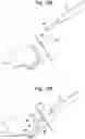 Fig. 22 - Systems and methods for haptic control of a surgical tool