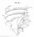 Fig. 06 - Bone fixture for a medical prosthesis
