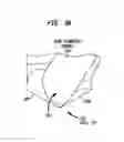 Fig. 08 - Bone fixture for a medical prosthesis
