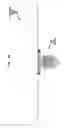 Fig. 10 - Bone fixture for a medical prosthesis