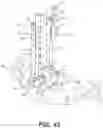 Fig. 33 - MIS cross-connector