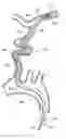 Fig. 01 - SYSTEMS AND METHODS FOR CATHETER ADVANCEMENT