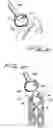 Fig. 07 - VACUUM ASSISTED SURGICAL DISSECTION TOOLS