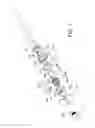 Fig. 07 - Trocar support