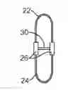 Fig. 01 - METHODS AND SYSTEMS FOR LATERALLY STABILIZED CONSTRAINT OF SPINOUS PROCESSES