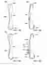 Fig. 08 - METHODS AND SYSTEMS FOR LATERALLY STABILIZED CONSTRAINT OF SPINOUS PROCESSES