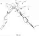 Fig. 11 - Spinal implant system and method