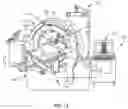 Fig. 12 - Spinal implant system and method