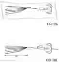 Fig. 09 - Bone implants for the treatment of infection