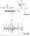 Fig. 22 - Bone implants for the treatment of infection