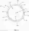 Fig. 03 - Method of performing a balloon kyphoplasty procedure using a scoop cannula
