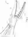 Fig. 03 - Knife auto-return assembly for electrosurgical shears