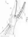 Fig. 03 - Latching clamp arm for electrosurgical shears