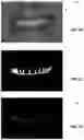 Fig. 08 - Tooth segmentation based on anatomical edge information