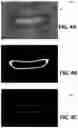 Fig. 12 - Tooth segmentation based on anatomical edge information