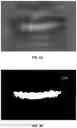 Fig. 13 - Tooth segmentation based on anatomical edge information