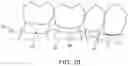 Fig. 06 - Digital dental examination and documentation