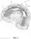 Fig. 02 - Teeth cleaning device