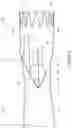 Fig. 04 - Thoracic aorta stent graft