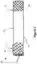 Fig. 02 - Method for fluid flow through body passages