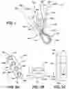 Fig. 02 - Implant having filament limbs of an adjustable loop disposed in a shuttle suture