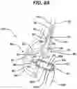Fig. 07 - Implant having filament limbs of an adjustable loop disposed in a shuttle suture