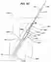 Fig. 09 - Implant having filament limbs of an adjustable loop disposed in a shuttle suture