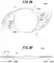 Fig. 07 - INTRAOCULAR LENS AND METHOD FOR PRODUCING SAME