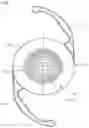 Fig. 01 - Multifocal ophthalmic lens having chromatic aberration correction
