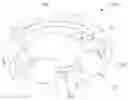 Fig. 01 - Photochemically induced engagement of intraocular implants